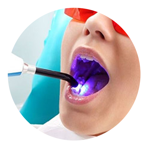 Laserterapia